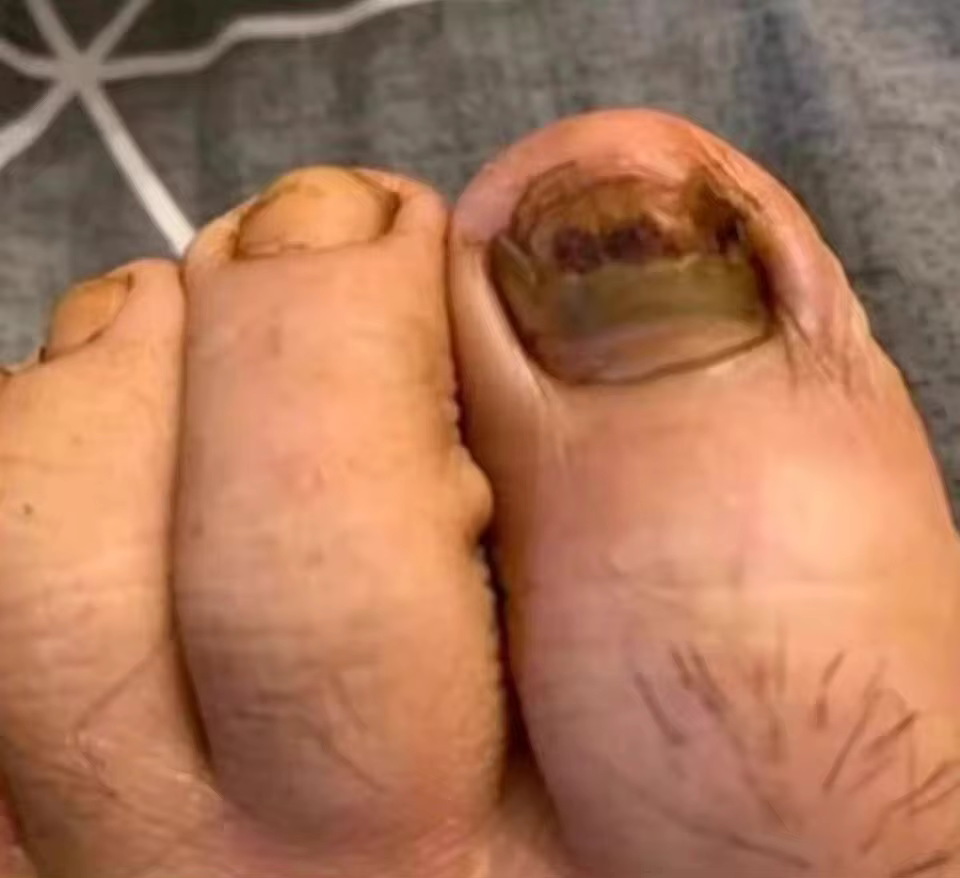 Antes del tratamiento